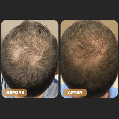 ReGrowth™ -  Root Activator Shampoo