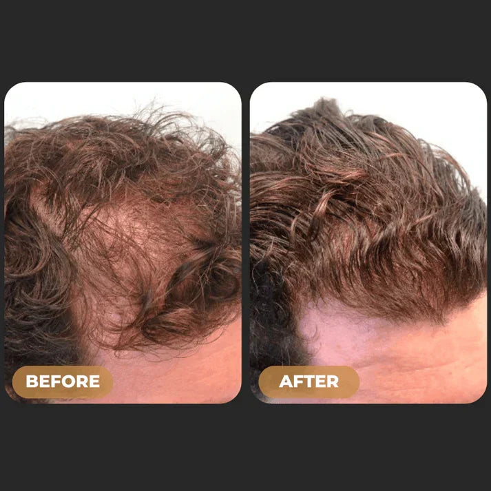 ReGrowth™ - Root Activator Spray