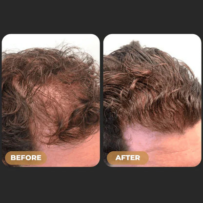 ReGrowth™ -  Root Activator Shampoo