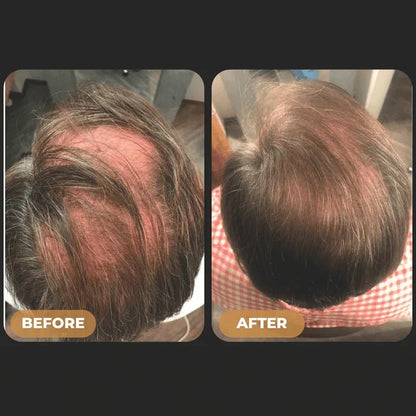 ReGrowth™ - Root Activator Spray