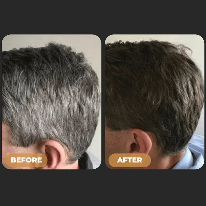 ReGrowth™ - Gray Hair Reverse Soap Bar