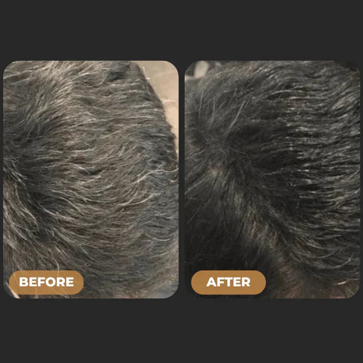 ReGrowth™ - Gray Hair Reverse Soap Bar