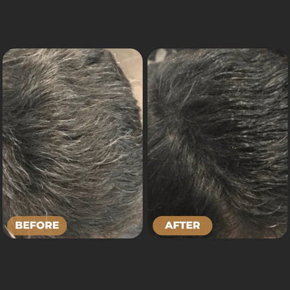 ReGrowth™ - Gray Hair Reverse Soap Bar
