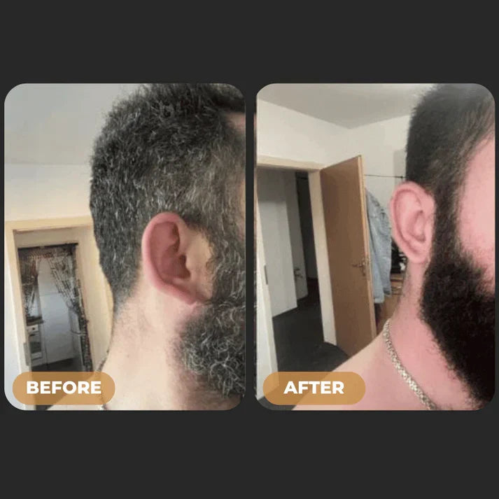 ReGrowth™ - Gray Hair Reverse Soap Bar