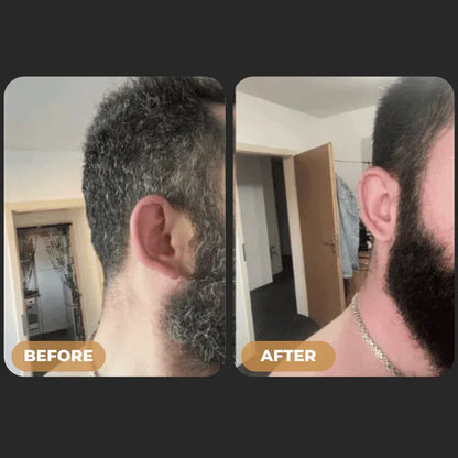 ReGrowth™ - Gray Hair Reverse Soap Bar